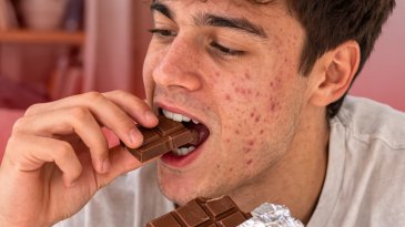 &iquest;El chocolate realmente provoca acn&eacute;?