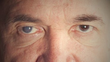 Degeneraci&oacute;n macular asociada a la edad (AMD)