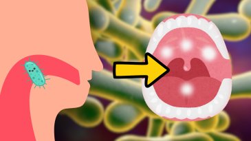 Difteria: la bacteria que no deb&eacute;s ignorar